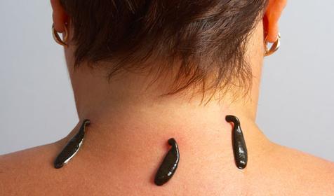 Лечение в пансионате Урал, г. Анапа