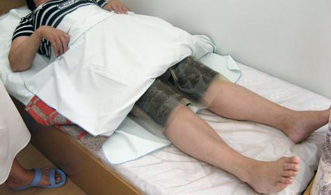 Лечение в пансионате Урал, г. Анапа